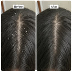 Bioderm Anti Dandruff Shampoo