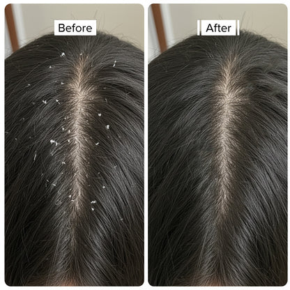 Bioderm Anti Dandruff Shampoo